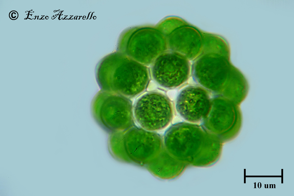 Coelastrum microporum 1000X